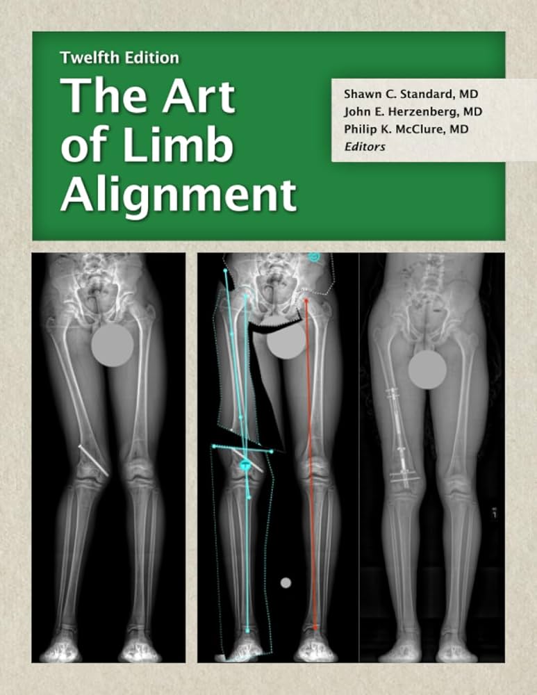 健康・医学 The Art of Limb Alignment, 12th Edition The Art of Limb Alignment, Twelfth Edition: Standard, Shawn